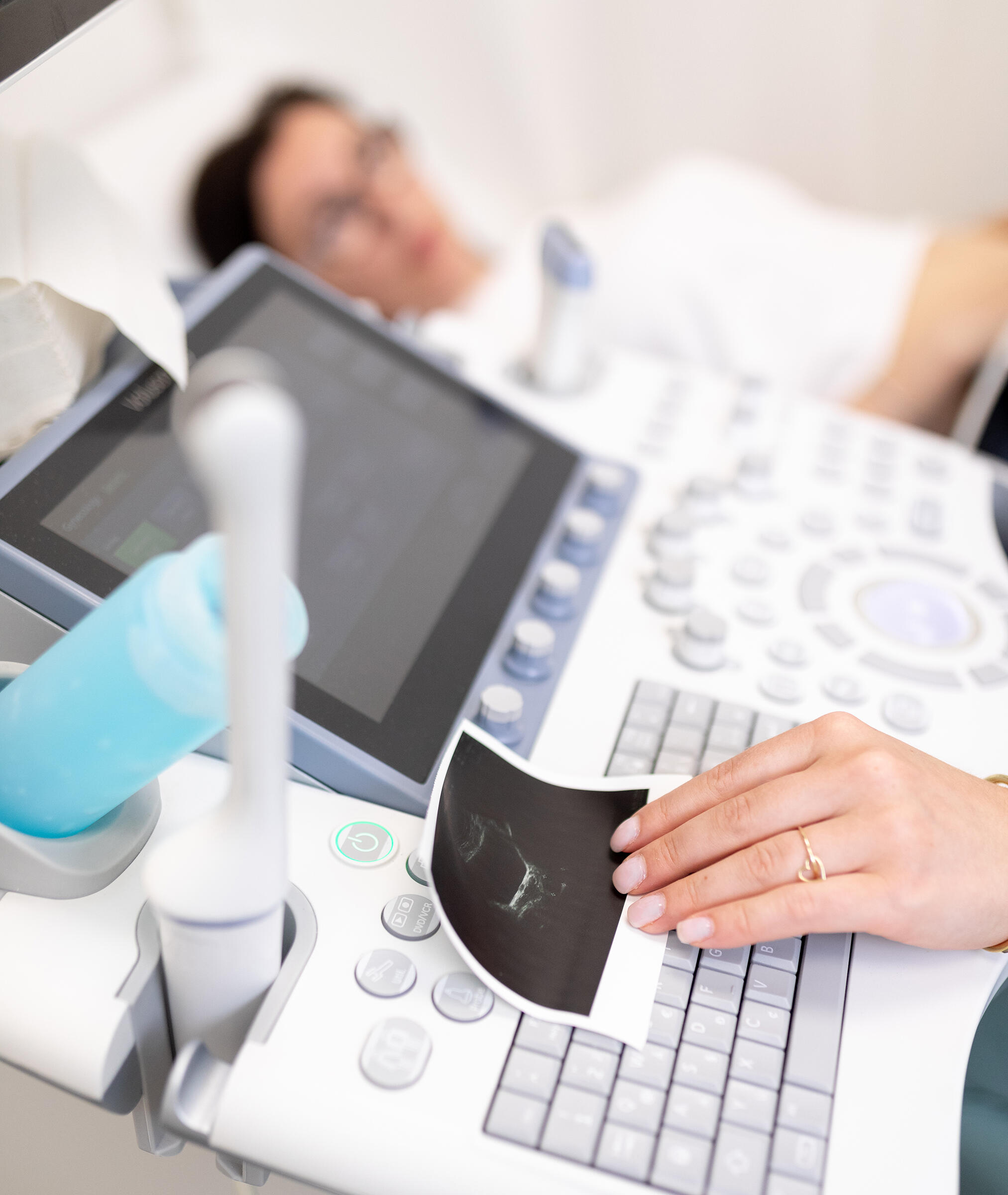 УЗД молочних залоз у Львові